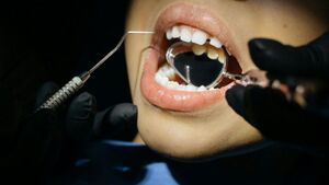 Fermeture d\u2019un espace entre dents\u202f: solutions esth\u00e9tiques modernes en Suisse