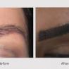 Reason of Thinning Eyebrows or Sparse