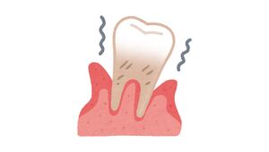 The Silent Threat of Periodontal Disease: Why It\u2019s Critical to Address Gum Health Early