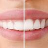 How Can Gum Disease Influence Your Overall Health?