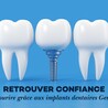 Retrouver confiance et sourire gr\u00e2ce aux implants dentaires Gen\u00e8ve