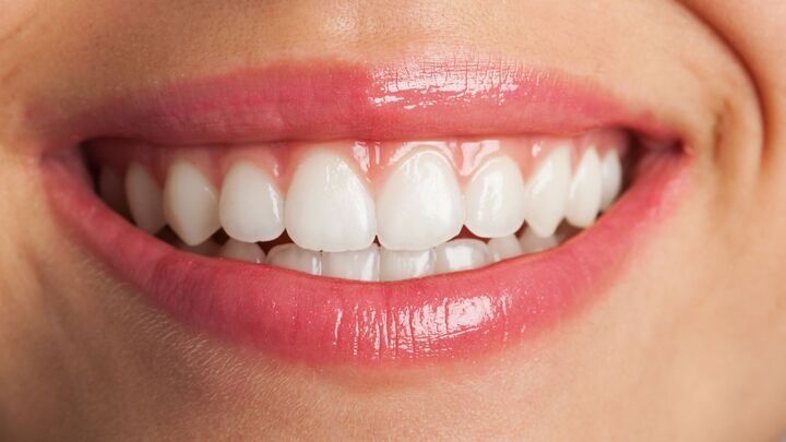 Avantages et risques liés aux dents et bien-être, résumé ici