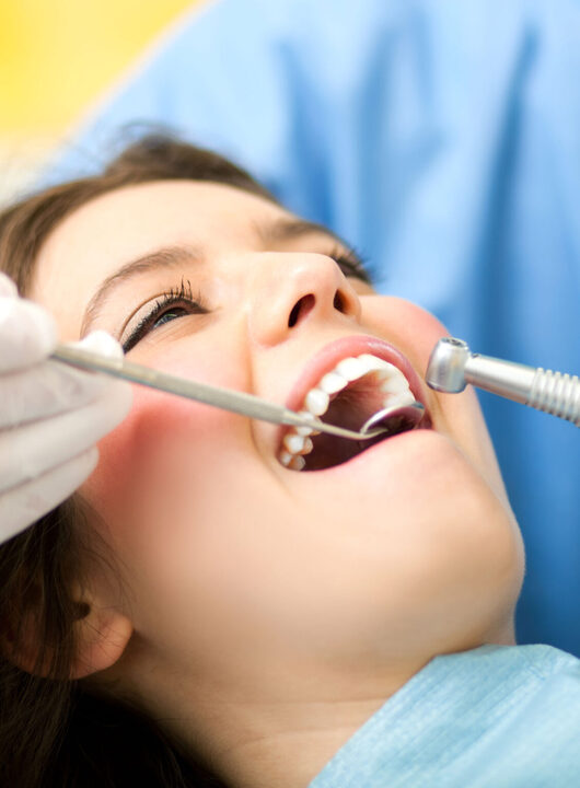 Why Choose a Houston Dentist for Your Smile Makeover?