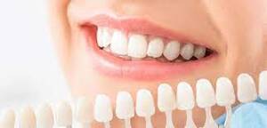 What is the Procedure for Full Reconstruction of the Mouth?