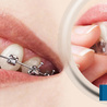 Best Orthodontic treatment in Jaipur