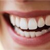 What Are The Main Advantages And Disadvantages Of Teeth Cleaning Before And After?