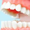 The Rise of Teeth Whitening: Why Castle Hills is Leading the Way in Lewisville and The Colony