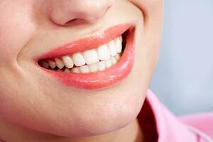 Why Choose Houston Heights Dental Implants for Your Dental Needs?