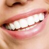 What Are Types Of Teeth Whitening Options?