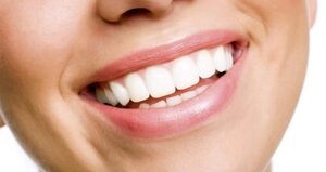 What Is The Difference: Veneers Vs. Lumineers?