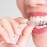 Invisalign in Geneva: Benefits and What to Expect