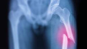 From Aches to Fractures: When to See an Orthopaedic Specialist