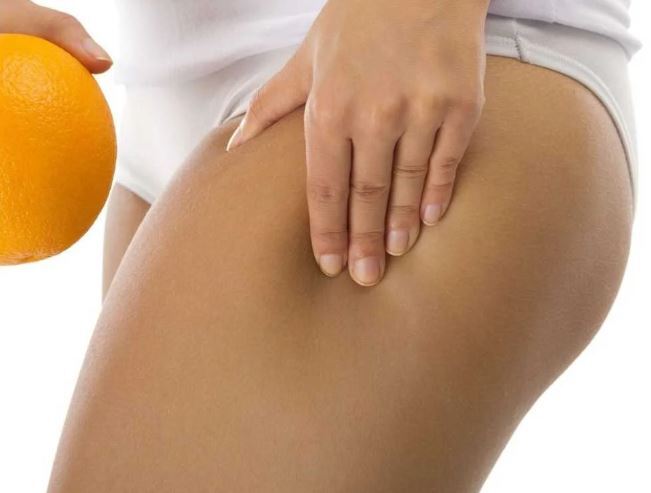 Exercise to Reduce Cellulite: Tone Your Body and Smooth Your Skin
