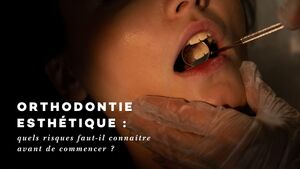 Orthodontie esth\u00e9tique : quels risques faut-il conna\u00eetre avant de commencer ?