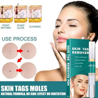 Dr Reilly Skin Tag Remover